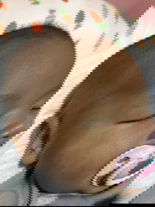 น้อง2เดือนหน้าแตกแห้งกร้าน