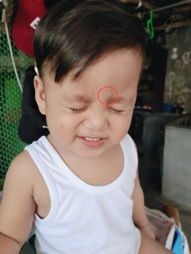 WHITE MARKS