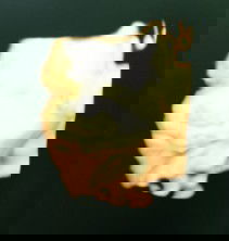 Hamil 34 Wek BBJ kurang