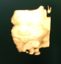 Hamil 34 Wek BBJ kurang