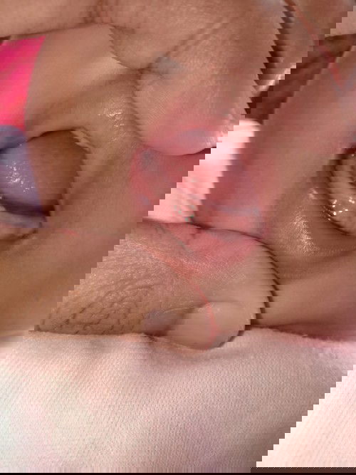 Apakah ini bakal gigi bayi?