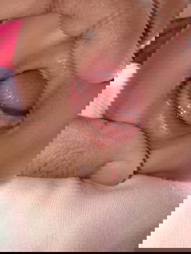 Apakah ini bakal gigi bayi?