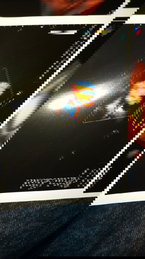 Ada lilitan pada bayi di usia 36 minggu