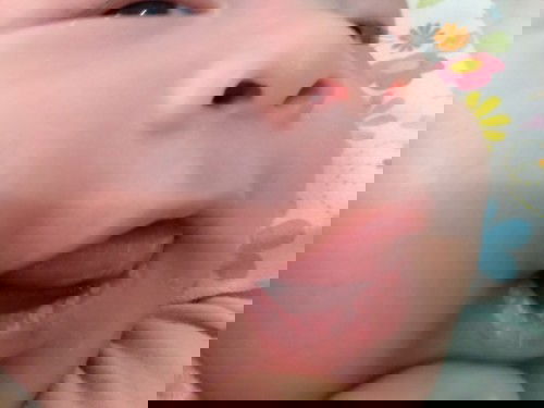 Bibir dan lidah putih berbintik