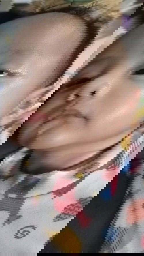 Cara mengatasi batuk pada bayi 3bln