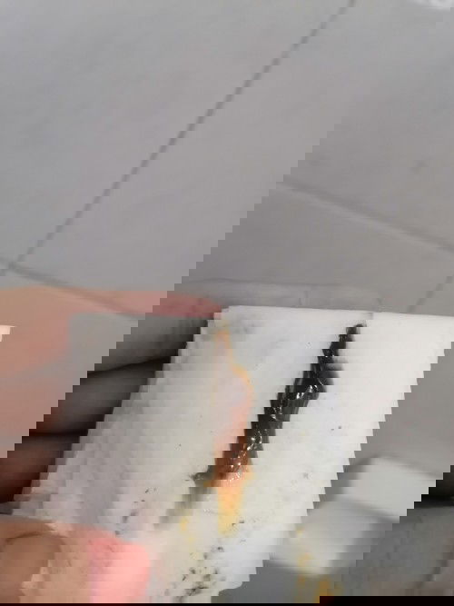 Masakit ang puson at tagiliran left side, is it threatened miscarriage?