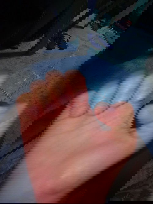 narmal ba nag iiba kulay ng kuko 35 waeks