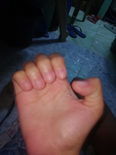 narmal ba nag iiba kulay ng kuko 35 waeks