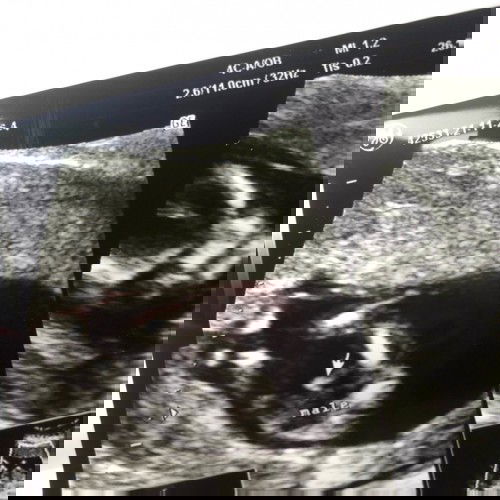 ❤️❤️❤️ 13w ทราบเพศกันหรือยังจ๊ะ