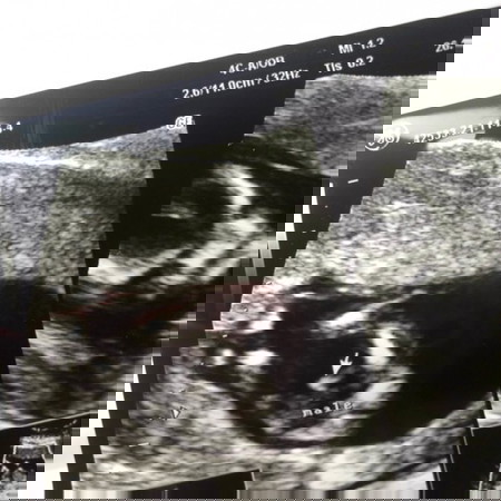 ❤️❤️❤️ 13w ทราบเพศกันหรือยังจ๊ะ