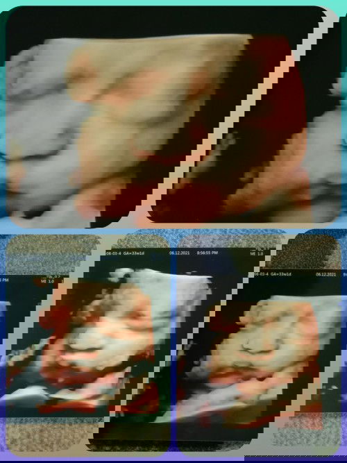 Hai slmat mlm smua skrg sya dh 33w ada x mama2 yg sma week dgn sya😊😊 #