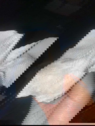 แบบนี้ใกล้คลอดไหมค่ะ