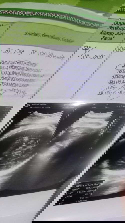 Hpl telat, 41 week + 3 day