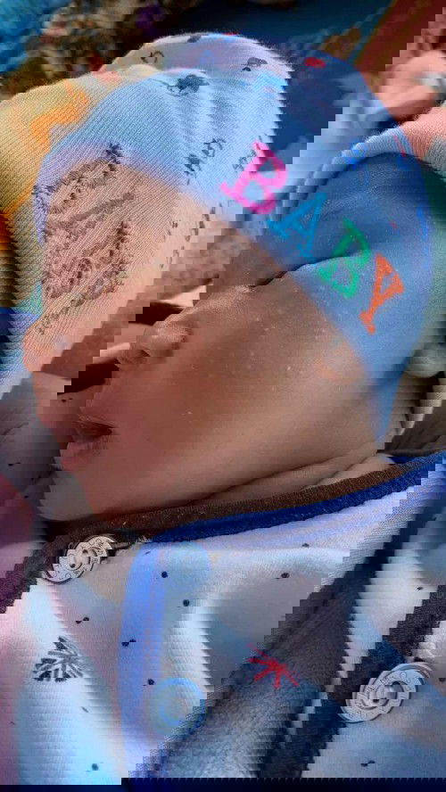 หน้าเป็นผื่นขึ้นบริเวณใบหน้า