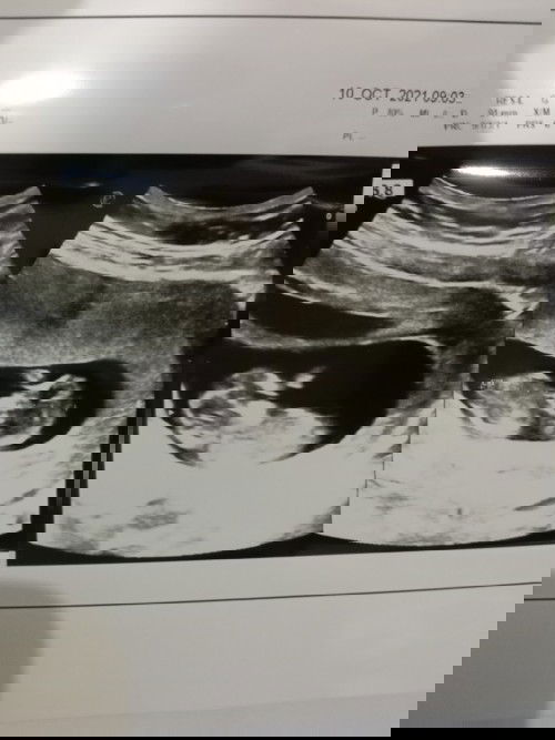 Semangat menyambut baby twins