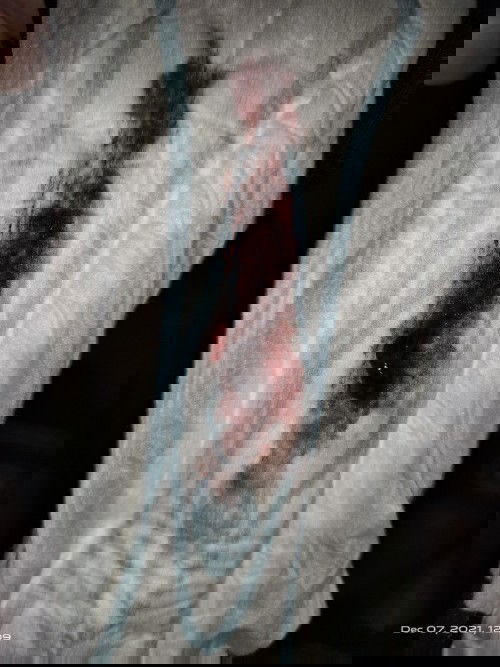 Normal lang po ba ito pagkatapos ma IE na may ganito 1cm pa lang po ako sabi.