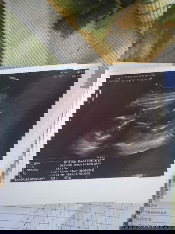 แบบนี้น้องตัวใหญ่หรือยังค่ะ
4เดือน