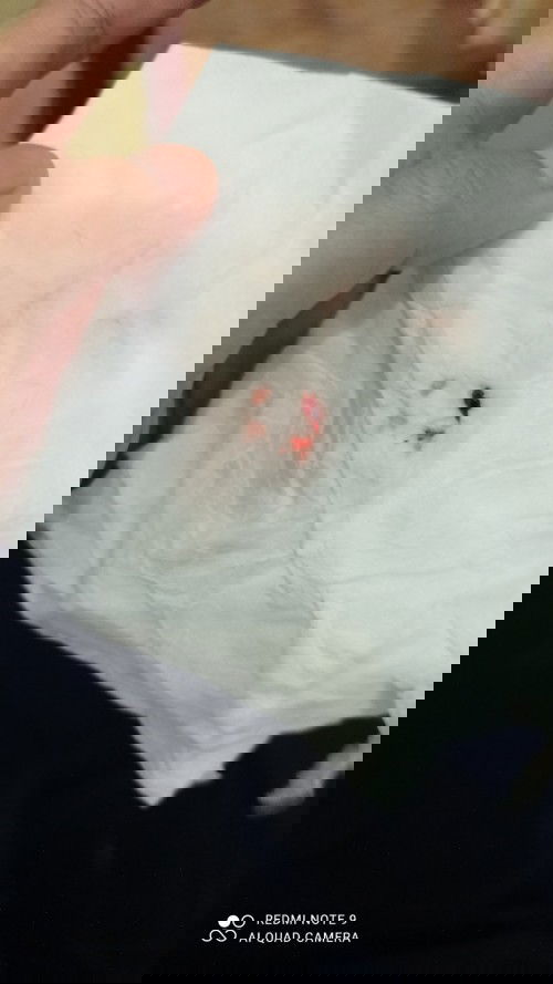 Tanda-tanda akan melahirkan kah?