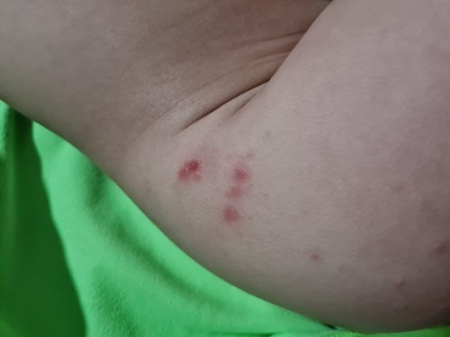 Worried mama of 15 month old