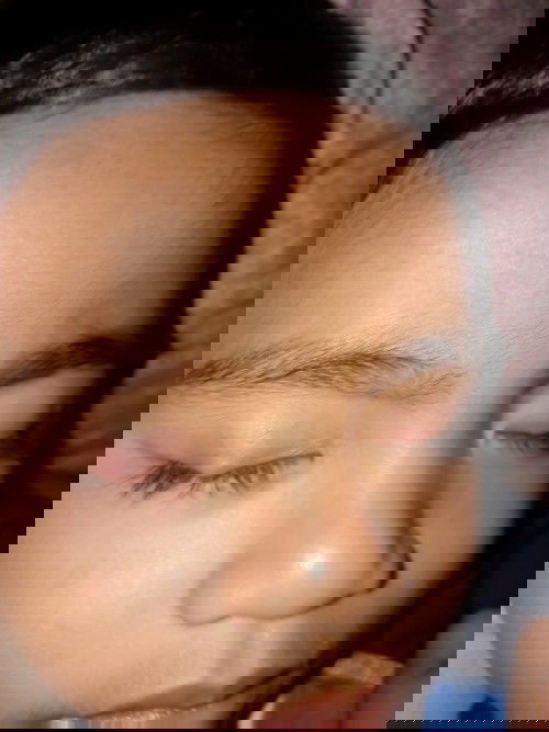 Ano po kaya eto at my gamot Po b dto sabe nila kulite daw po ano po kya ang pwede kung gawin