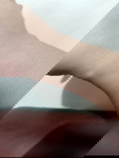 Hello Po magtatanung Po olit ako about nmn Po sa kamay ko po