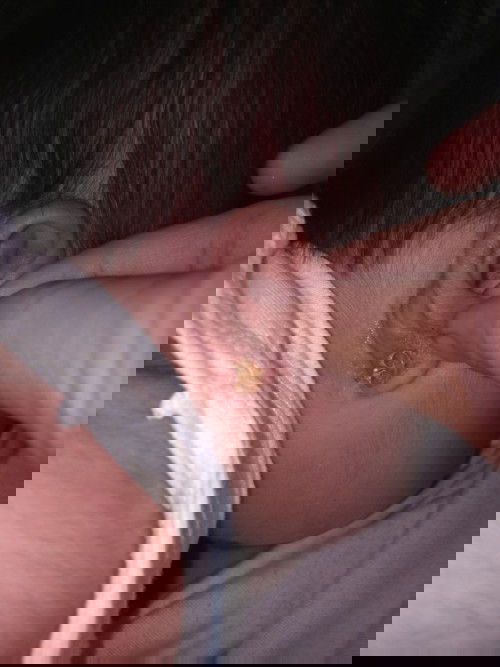 Mamasa-masang sugat sa likod ng tenga ni baby