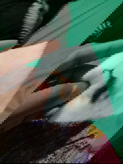 มีมูกออกค้ะแต่ไม่มีอาการปวดท้องค้ะ