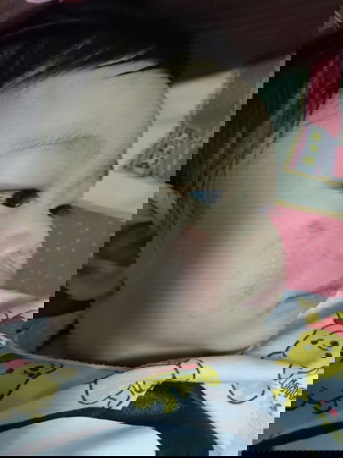 เป็นผดแบบนี้ควรทำยังไงคะ