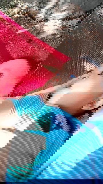 ทารกผมร่วง