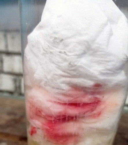 เลือดแดงสดออกแล้วตามด้วยเลือดน้ำตาล