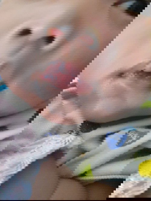 Bercak putih dilidah dan bibir