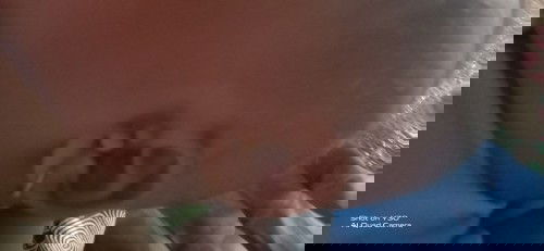 Mata kepiting pada bayi