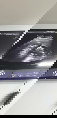 เบบี๋ 14 วิค