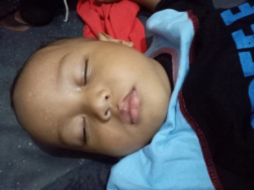 bercak putih
