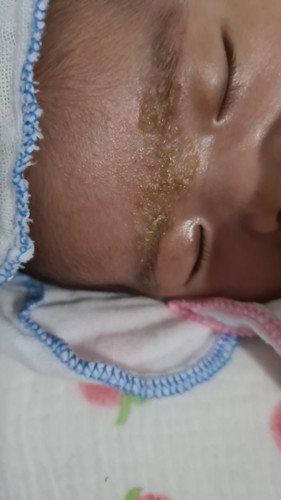 Các mom có kinh nghiệm cho e hỏi bé bị vậy là bị j vậy ạk ? Có cách nào trị hết k ạk ?