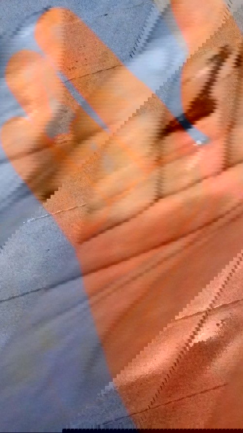 วันนี้โดนหมอกระตุ้นปากมดลูกมาเมื่อตอนกลางวันตกกลางคืนมีเลือดออกเเบบนี้ควรไปโรงพยาบาลมั้ยคะ