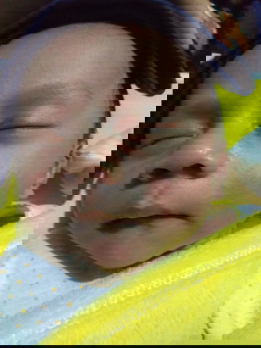 Masalah brintisan pada baby