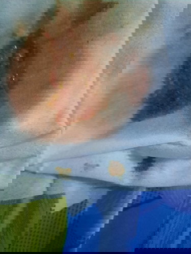 Phân của bé như thế này có sao không mọi nguơi .