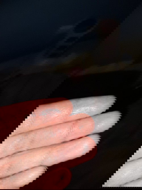 ปากมดลูกเปิด1เซนแล้วคะ
แล้วมีน้ำใสๆออกมาทีละนิดจากช่องคลอดคือใกล้คลอดแล้วใช่มั้ยคะตอนนี้40Wแล้วคะ