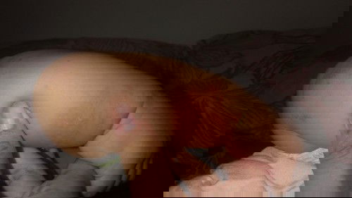 Ruam merah berair ini alergi atau apa?