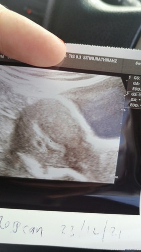 Pintu rahim tertutup