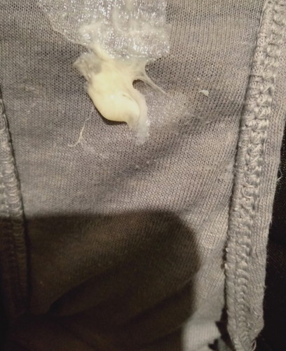 Mucus Plug?
Hello,mga momshies mucus plug na po ba ito? 38weeks preggy here,thank you..