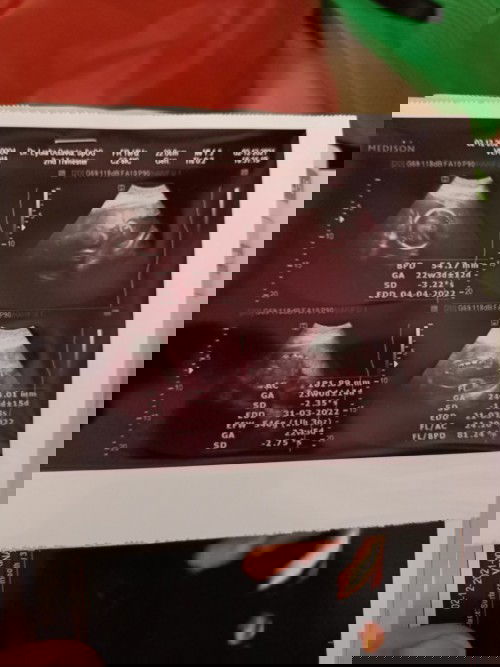 Cara agar BB janin naik