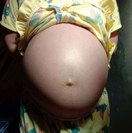 ท้องลูกชาย