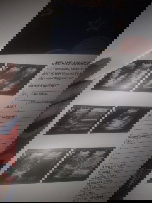 Ok lng po ba yan medyo dpo npaliwanag saken kung ok lng ba c baby sa tummy ko