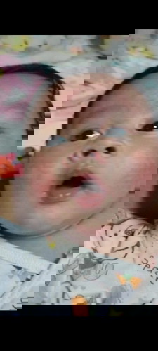 หน้าน้องเปนผื่นแห้งๆแดงๆ