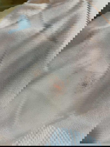 Discharge/blood stain