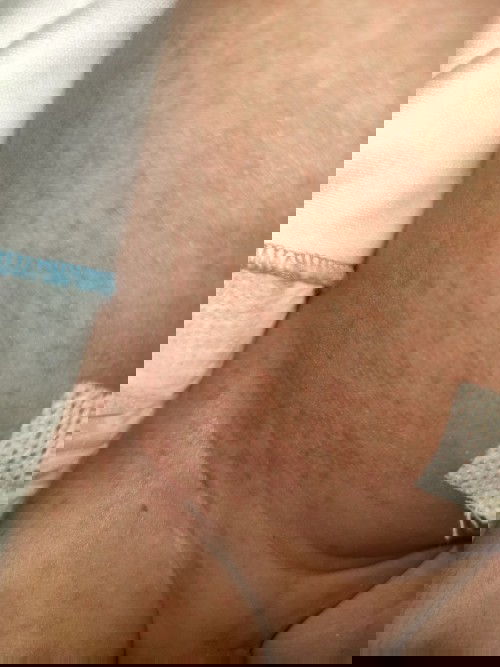 Bintik kecil berwarnah merah