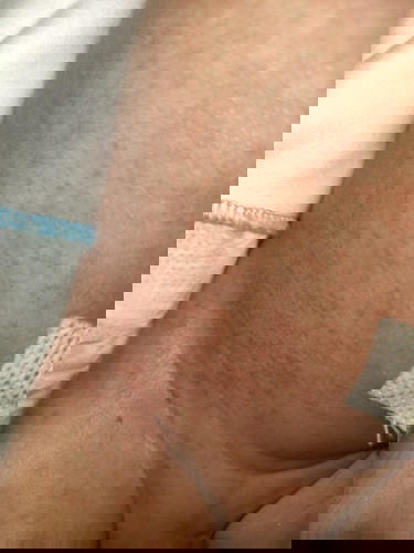 Bintik kecil berwarnah merah