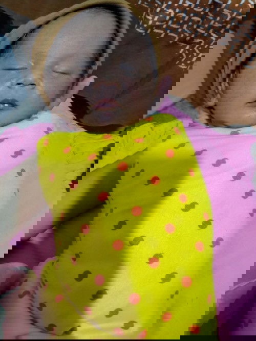 Cara hilangkan bruntusan di pipi akibat asi